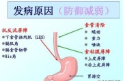 胆管癌放疗患者反应大该怎么办？如何能减轻副作用